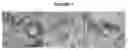 Fig. 07 - Methods and compositions for detecting amyotrophic lateral sclerosis