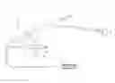 Fig. 01 - BALLOON CATHETER