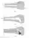 Fig. 02 - CURVED ORTHOPEDIC TOOL