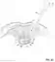 Fig. 08 - Spinal implant and instrument