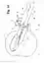 Fig. 12 - Methods and instrumentation for positioning implants in spinal disc space in an anterior lateral approach