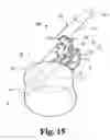 Fig. 13 - Methods and instrumentation for positioning implants in spinal disc space in an anterior lateral approach