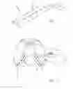 Fig. 02 - Surgical tape and method for using same