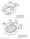 Fig. 06 - Birthing gloove