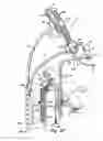 Fig. 15 - SURGICAL INSTRUMENT