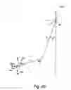 Fig. 35 - SURGICAL INSTRUMENT