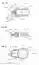 Fig. 02 - Method and apparatus for vascular and visceral clipping