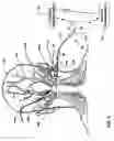 Fig. 02 - Flexible introducer