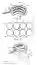 Fig. 06 - Systems and methods treating a vertebral body related applications