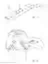 Fig. 02 - Necklift procedure and instruments for performing same