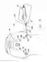 Fig. 08 - Necklift procedure and instruments for performing same