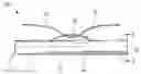 Fig. 01 - Visceral anchors for purse-string closure of perforations