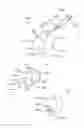 Fig. 49 - Percutaneous spinal implants and methods