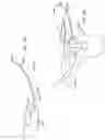 Fig. 71 - Percutaneous spinal implants and methods