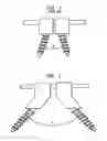 Fig. 02 - Methods for stabilizing bone using spinal fixation devices