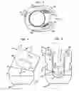 Fig. 03 - Methods for stabilizing bone using spinal fixation devices