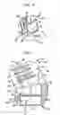 Fig. 04 - Methods for stabilizing bone using spinal fixation devices