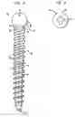 Fig. 05 - Methods for stabilizing bone using spinal fixation devices