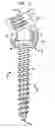 Fig. 07 - Methods for stabilizing bone using spinal fixation devices