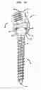 Fig. 08 - Methods for stabilizing bone using spinal fixation devices