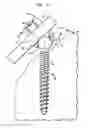 Fig. 11 - Methods for stabilizing bone using spinal fixation devices
