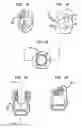Fig. 13 - Methods for stabilizing bone using spinal fixation devices