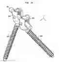 Fig. 15 - Methods for stabilizing bone using spinal fixation devices