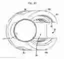 Fig. 18 - Methods for stabilizing bone using spinal fixation devices