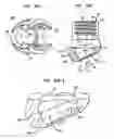 Fig. 20 - Methods for stabilizing bone using spinal fixation devices