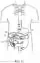 Fig. 02 - CARDIAC ACTIVITY CONTROL OF GASTRIC ELECTRICAL STIMULATOR