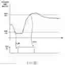 Fig. 06 - CARDIAC ACTIVITY CONTROL OF GASTRIC ELECTRICAL STIMULATOR