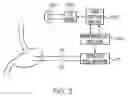 Fig. 07 - CARDIAC ACTIVITY CONTROL OF GASTRIC ELECTRICAL STIMULATOR