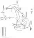 Fig. 22 - CARDIAC ACTIVITY CONTROL OF GASTRIC ELECTRICAL STIMULATOR
