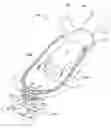 Fig. 01 - Methods and apparatus for adjusting blood circulation
