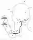 Fig. 01 - Method of implanting a medical lead