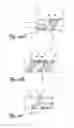 Fig. 07 - RF rejecting lead