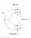 Fig. 03 - Balloon expandable bioabsorbable drug eluting stent
