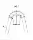 Fig. 08 - Balloon expandable bioabsorbable drug eluting stent