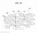Fig. 11 - Balloon expandable bioabsorbable drug eluting stent