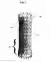 Fig. 02 - Active stent