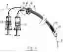 Fig. 03 - Inflatable artificial valve