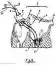 Fig. 05 - Inflatable artificial valve