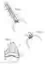 Fig. 03 - Prosthetic valve for transluminal delivery