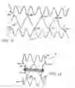 Fig. 06 - Prosthetic valve for transluminal delivery
