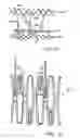 Fig. 09 - Prosthetic valve for transluminal delivery