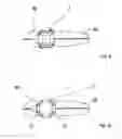 Fig. 08 - Intervertebral prosthesis or disk prosthesis