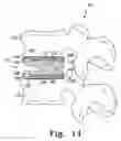 Fig. 12 - Spinal arthroplasty device compatible with neural integrity monitoring
