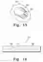 Fig. 13 - Spinal arthroplasty device compatible with neural integrity monitoring