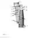 Fig. 06 - Artificial joint with locking mechanism