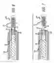 Fig. 04 - Stretch resistant therapeutic device
